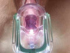 Stella St. Rose - Extreme Gaping, See my Cervix Close-Up using a Speculum